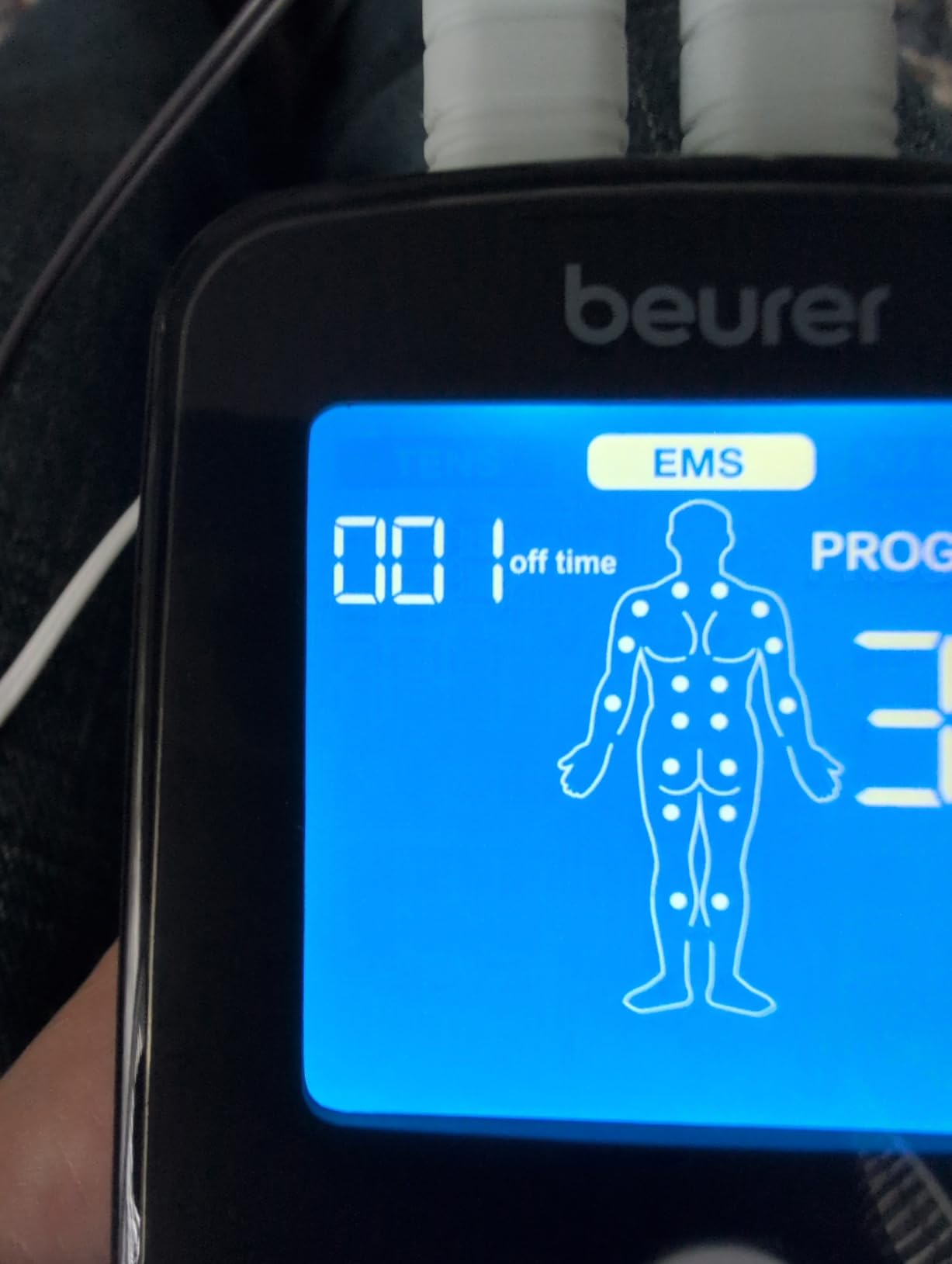 Beurer EM49 Digital TENS & EMS Device for Pain Relief and Muscle Stimulation, 15 TENS Programs, 35 EMS Programs, 2 Adjustable Channels with 4 Self-Adhesive Electrodes customer photo 1