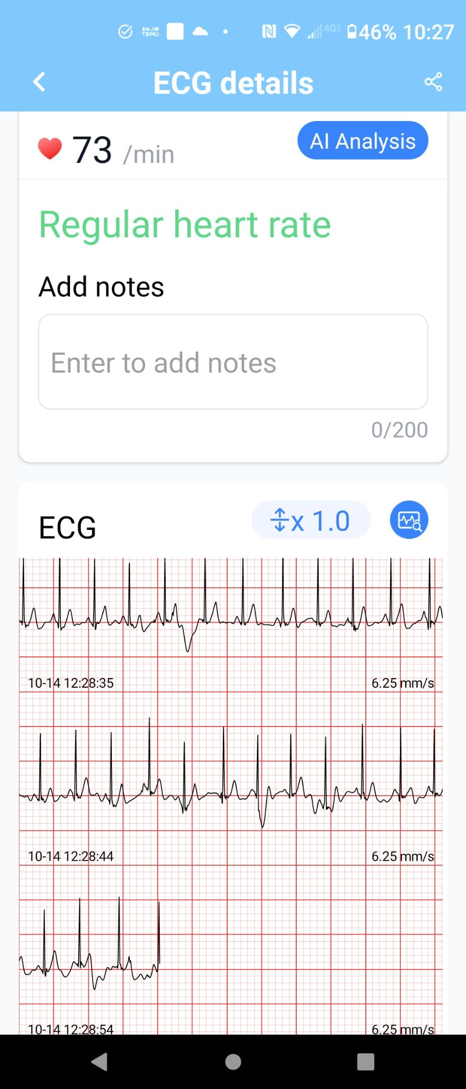 Portable Heart Rate Monitor, Wireless Home Use Heart Rhythm Tracker, Heart Monitoring Devices, Smartphone App Compatible with iOS/Android customer photo 2