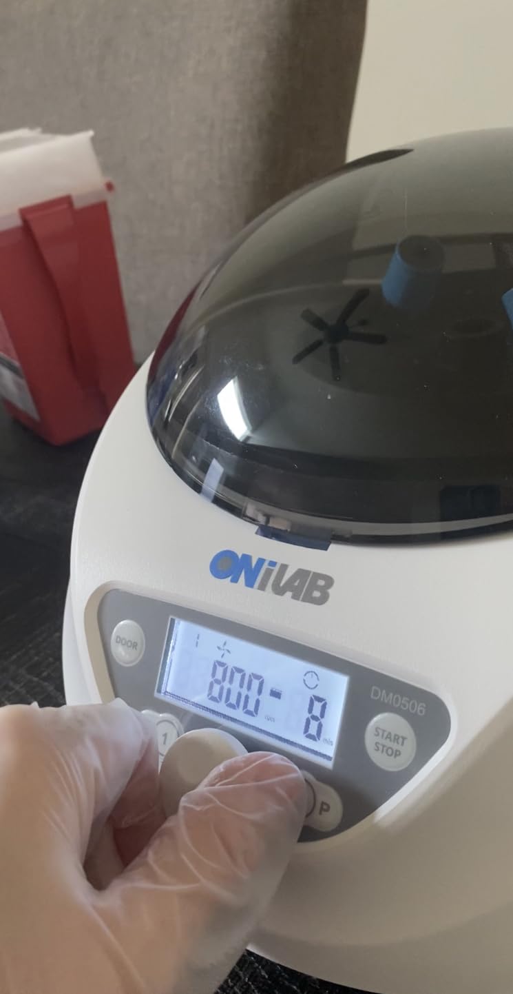 ONiLAB Lab PRP Benchtop Centrifuge 6x15mL/10mL/7mL/1.5-5ml, 300-5000rpm (Max. 2600xg RCF), LCD Digital Desktop Lab Centrifuge Timer 30sec-99min, Two Quick Start Programs customer photo 1
