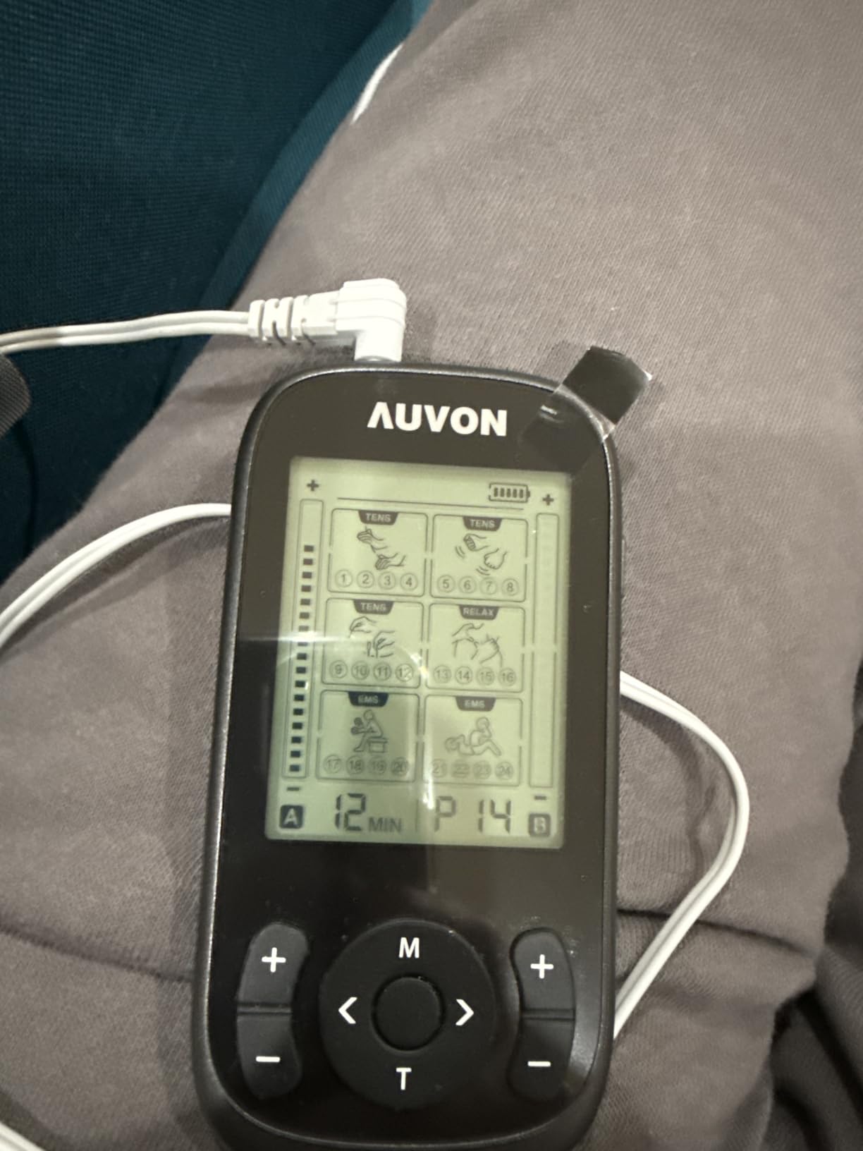 AUVON 3-in-1 TENS Unit Muscle Stimulator, EMS Massage Machine with 40 Intensities, 24 Modes Rechargeable Electronic Pulse Massager with 12 TENS Pads customer photo 2