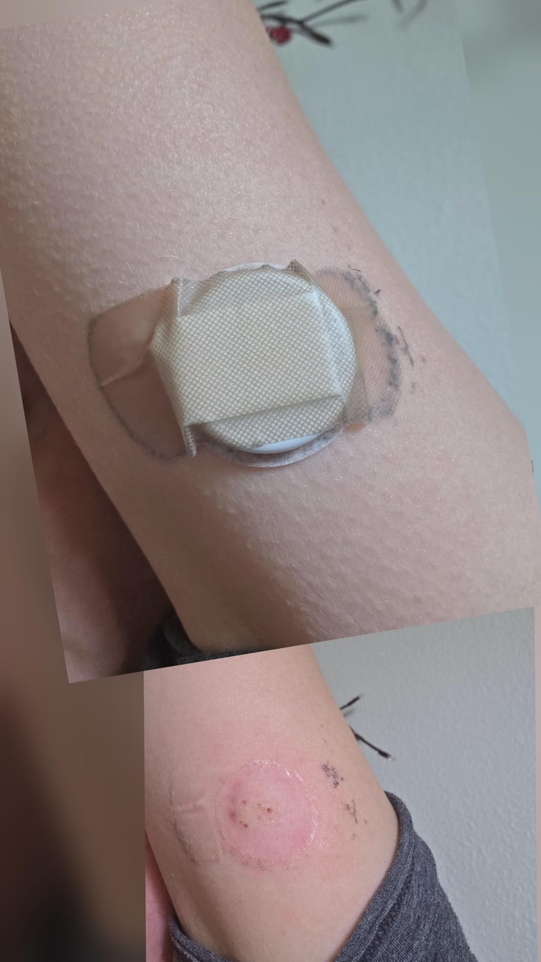 Lingo Continuous Glucose Monitor (CGM). Made by Abbott. Optimize Your Nutrition with Real-time Glucose Data & Insights. 1 Lingo biosensor lasts up to 14 Days*. Works with iOS and Android. US Only. customer photo 2