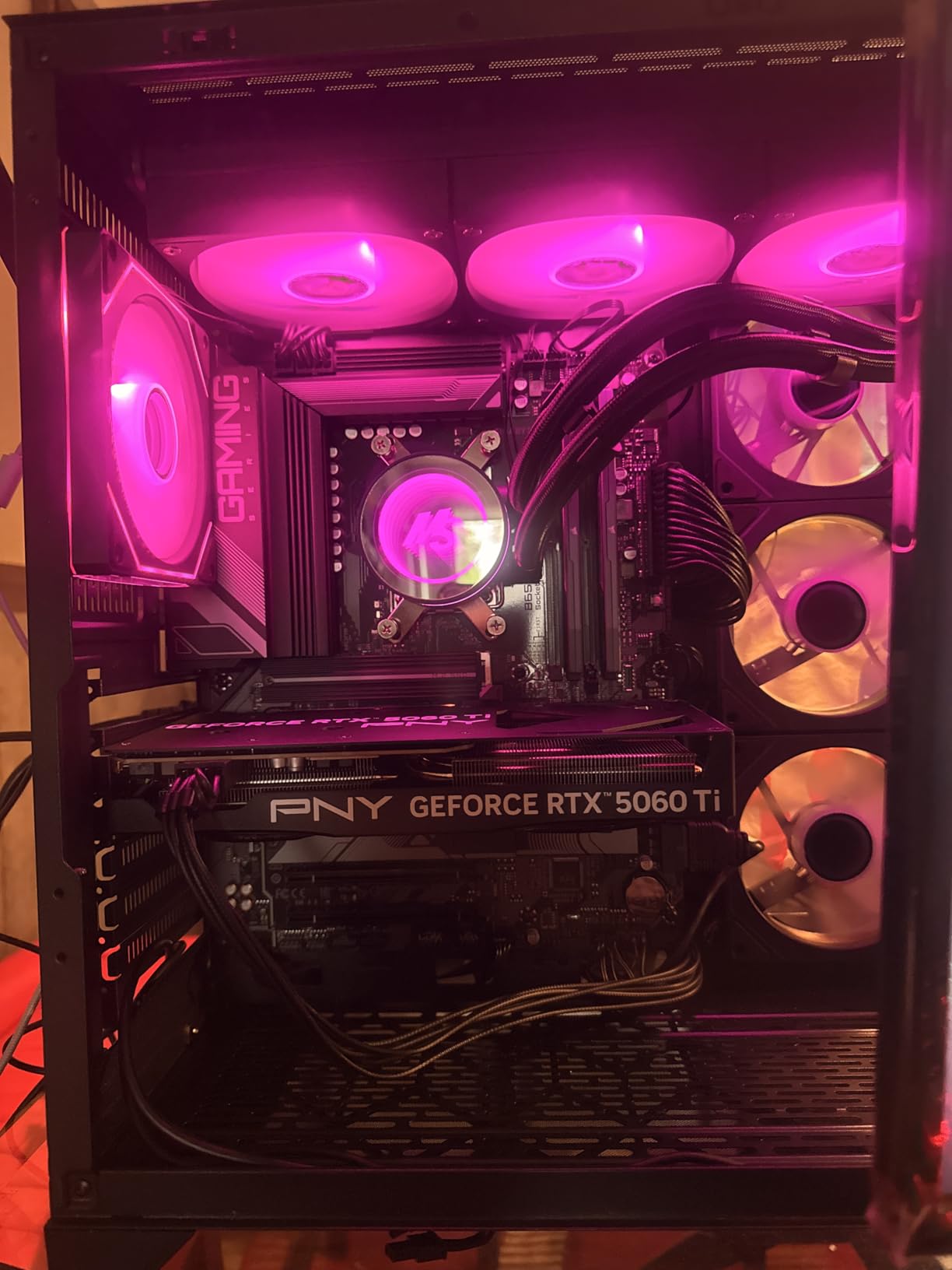 Minorsonic CPU Cooler 240mm Aio, Liquid Cooler CPU Low-Noise AMD AM5/AM4, Refrigeracion Liquida Water Cooling Systems, Intel LGA 1851/1700 PC Water Cooler 2 x 120 mm PWM ARGB Fans Black customer photo 1