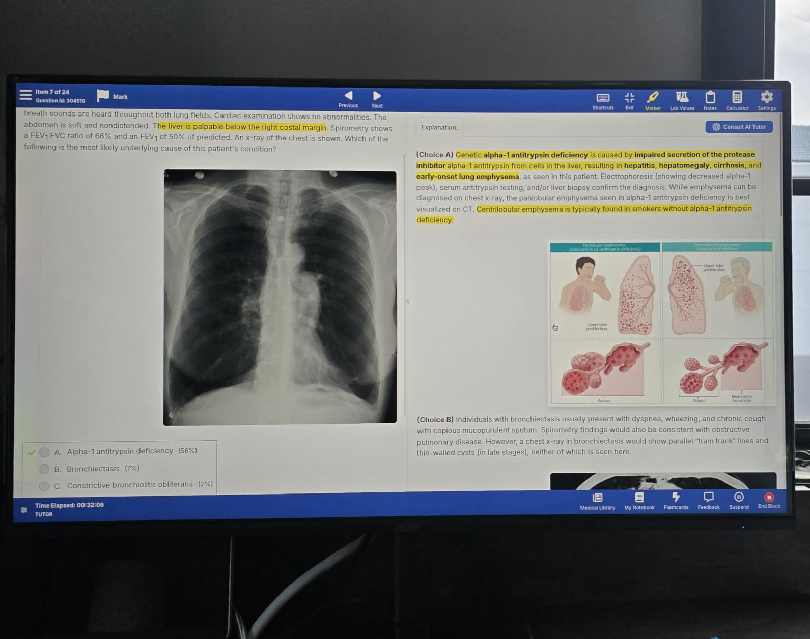 Acer 23.8in FHD 1920x1080 IPS 120Hz Office Monitor KB242Y G0bi | 1ms, AdaptiveSync (FreeSync Compatible), sRGB 99%, HDMI, VGA, VESA Mountable, Bluelight Filter, Flickerless Technology customer photo 2