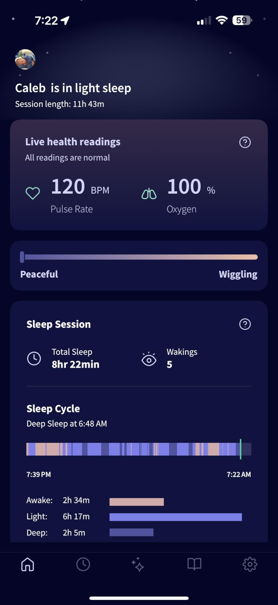 Owlet Dream Sock Smart Baby Monitor Tracks Heart Rate & Oxygen in Real Time Parents Receive Alerts, Sleep Insights & More via App - Bedtime Blue customer photo 1