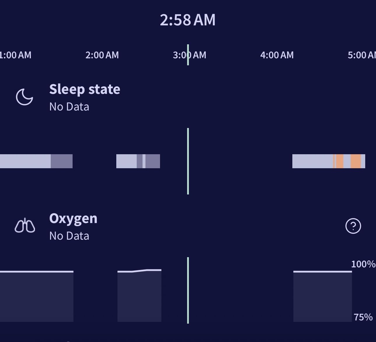 Owlet Dream Sock Smart Baby Monitor Tracks Heart Rate & Oxygen in Real Time Parents Receive Alerts, Sleep Insights & More via App - Bedtime Blue customer photo 2