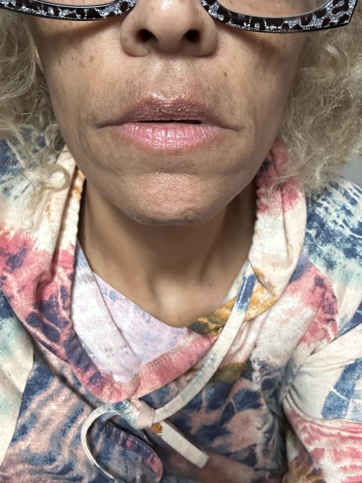 High Frequency Facial Wand/Machine with 5 Argon Parts Skin Care Tool for Wrinkles Reducing Face Skin Tightening. customer photo 1