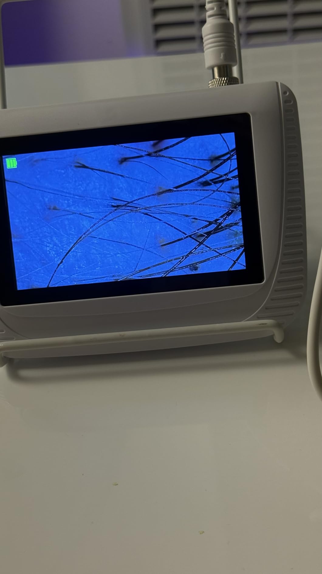 Scalp Analysis Machine, 5 Inch LCD Screen Skin Hair Analyzer customer photo 1