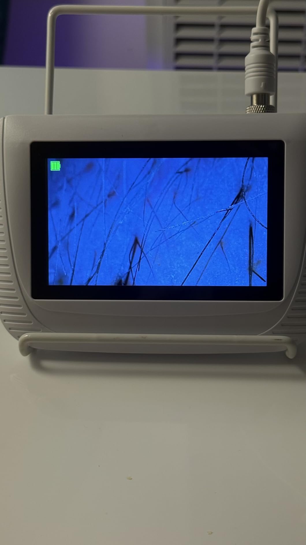 Scalp Analysis Machine, 5 Inch LCD Screen Skin Hair Analyzer customer photo 2