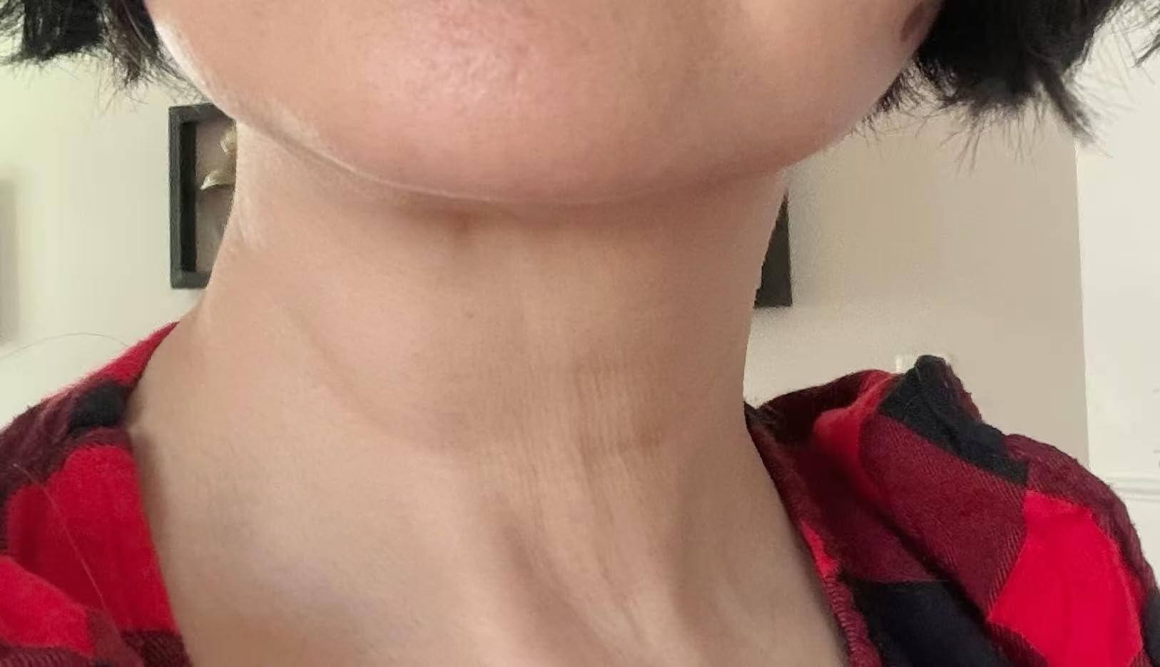 7-in-1 Microcurrent Facial Device, Gua Sha Red Light Face & Neck Massager customer photo 1