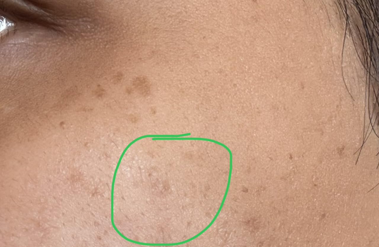 Microneedling Pen Microneedle Derma Roller Pen for Face Skin, Microneedle Micro Needle Roller 0.25mm Dermabrasion Roller for Men and Women Home Use customer photo 1