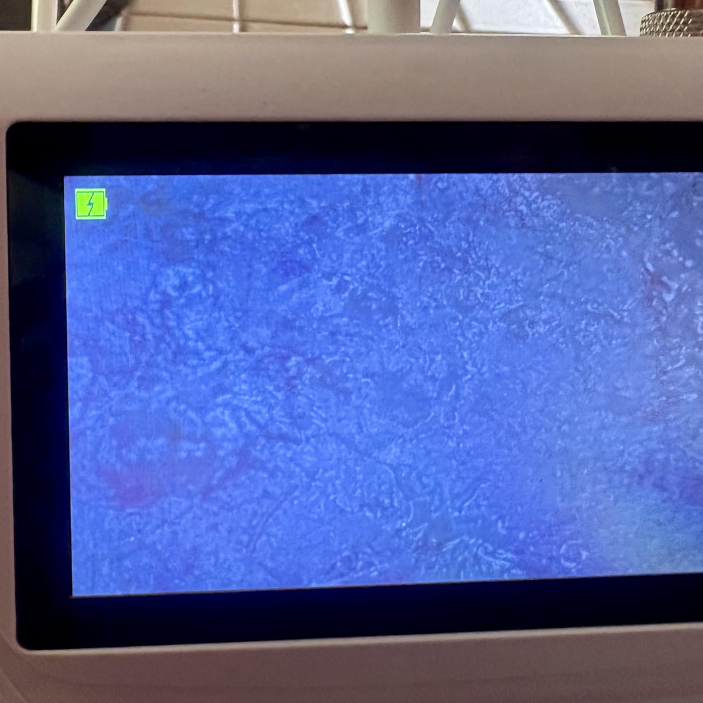 Professional Skin Hair Analyzer, Skin Scalp Analysis Machine customer photo 1