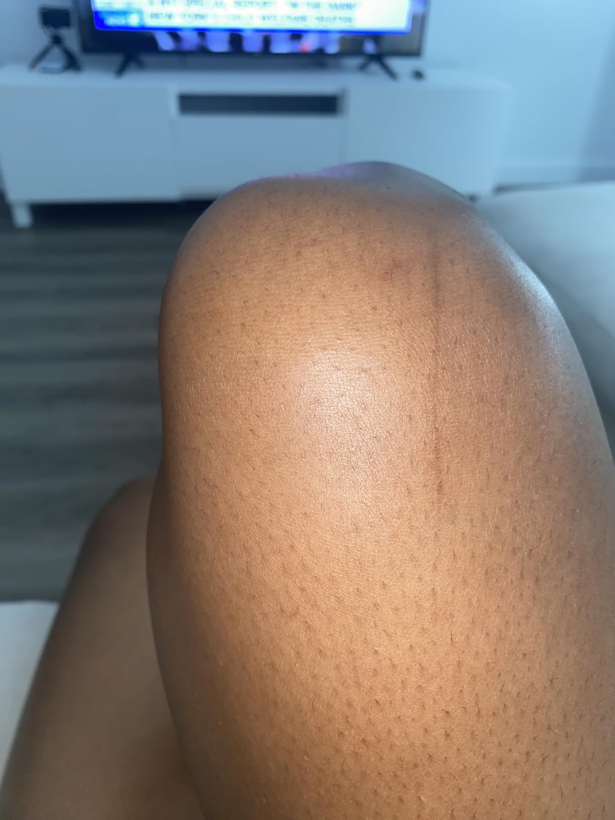 Microneedling pen M8S for Home Use customer photo 2