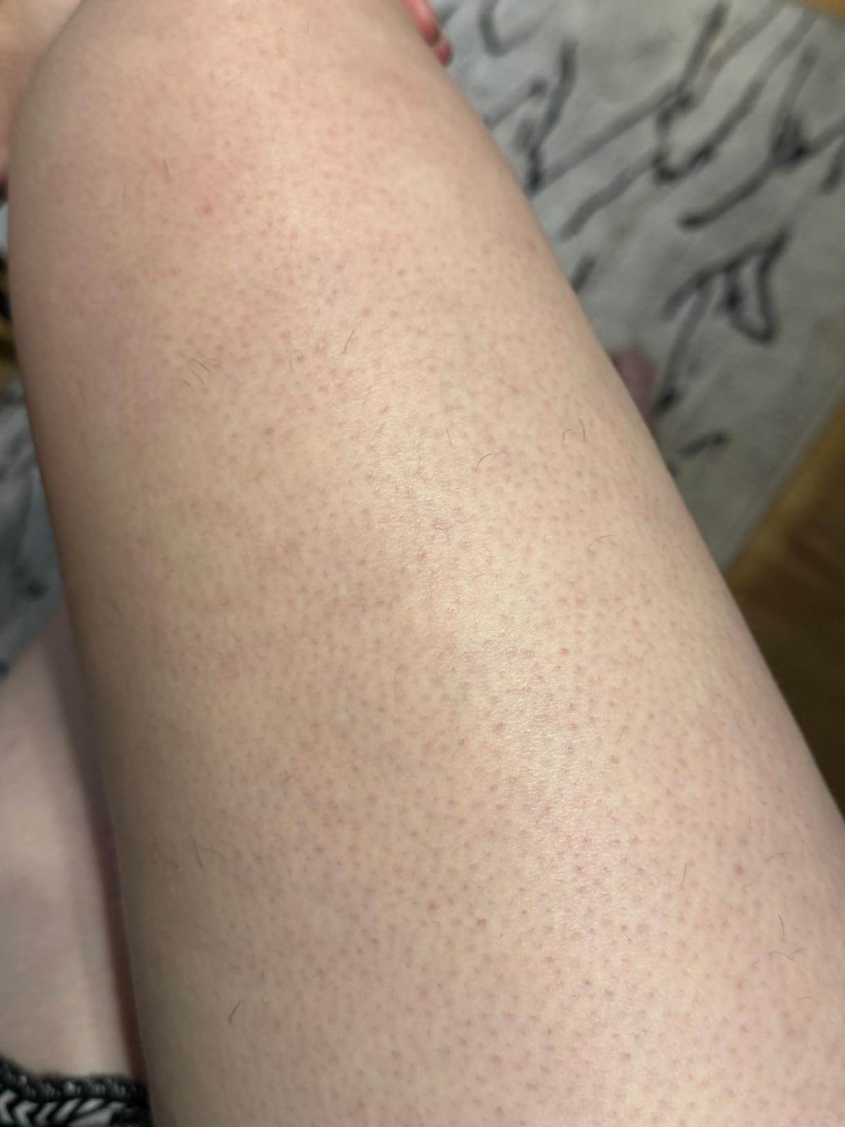 Braun IPL, Silk·Expert Pro 5, IPL Hair Removal for Women and Men, Permanent Laser Hair Reduction At-Home, 2 Heads, Pouch, Venus Razor, IPL5157 customer photo 2