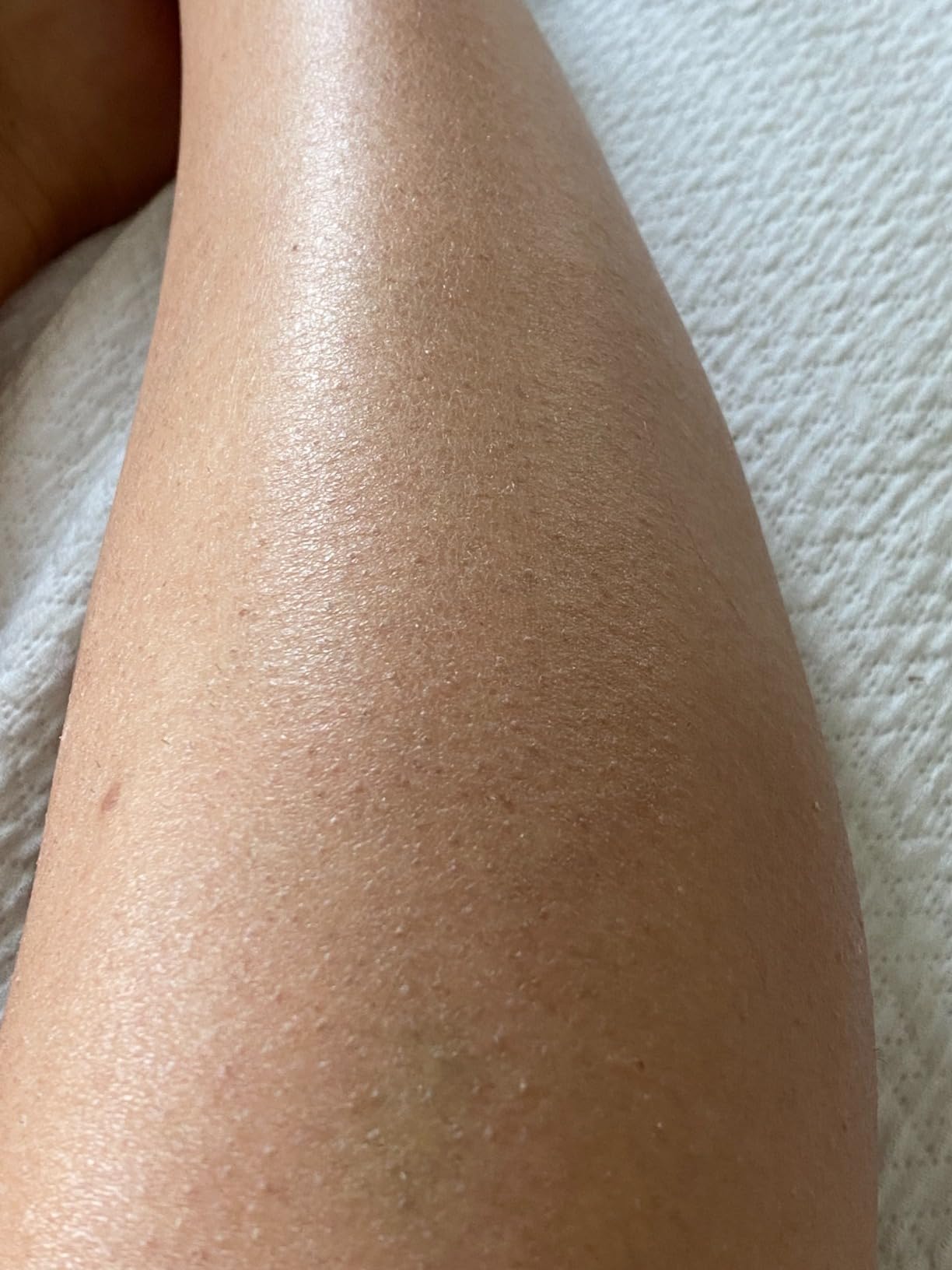 Braun IPL, Silk·Expert Pro 5, IPL Hair Removal for Women and Men, Permanent Laser Hair Reduction At-Home, 4 Heads, IPL5347 customer photo 2